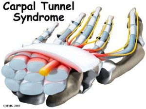 tunnel-carpien1